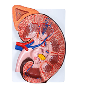 Enlarged Kidney Model 1 Part